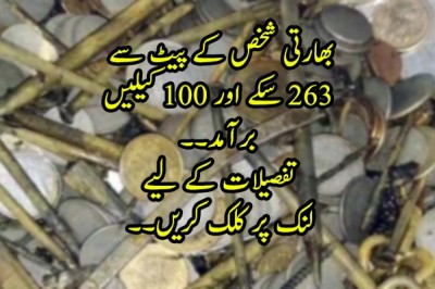 بھارتی شخص کے پیٹ سے 263 سکے اور 100 کیلیں برآمد